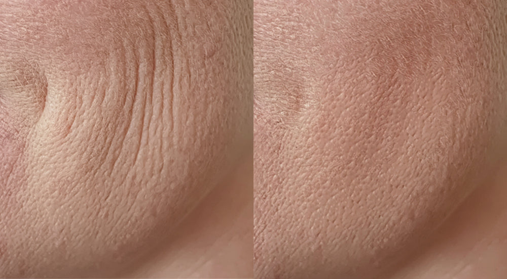 Before and After